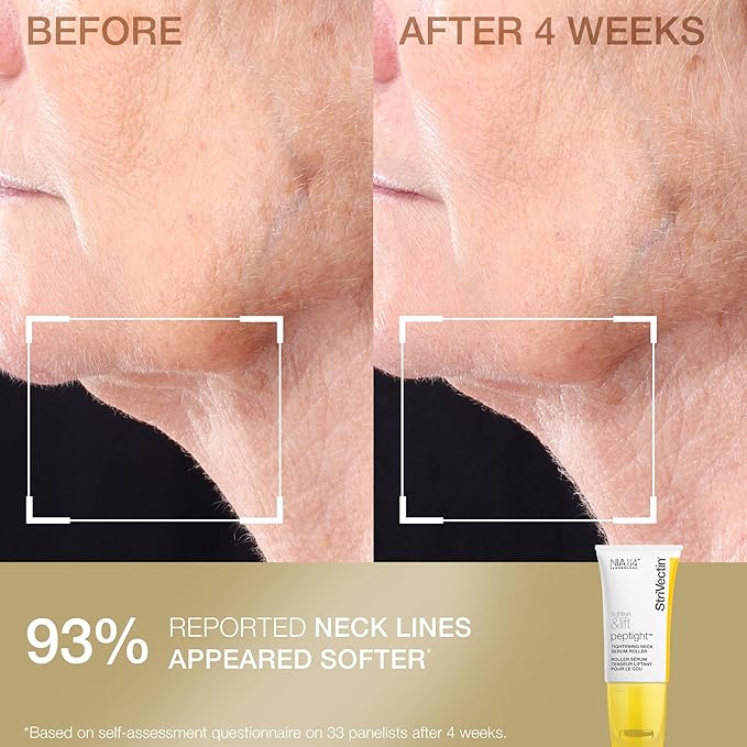StriVectin Tighten & Smooth Neck Cream & Neck Serum Roller 2-Piece Set