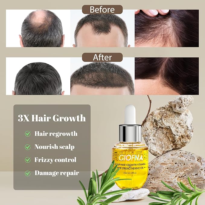 GIOFNA Hair Oil, Rosemary Serum with Bamboo Brush for Frizzy, Damaged Hair Growth Strengthening, Scalp and Argan Care for Women and Men