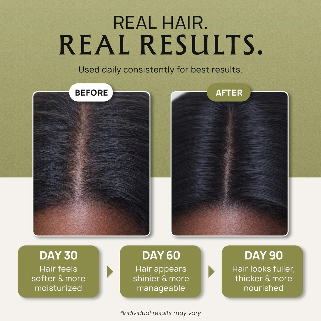Lebanta Batana Oil for Hair - Organic Castor Rosemary Scalp Oil 3.38 Fl Oz
