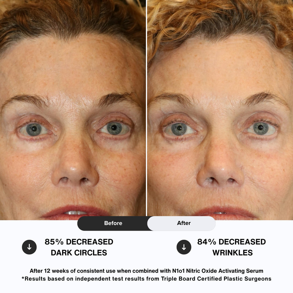 N1O1 Nitric Oxide Anti Aging Eye Cream, 0.5 oz