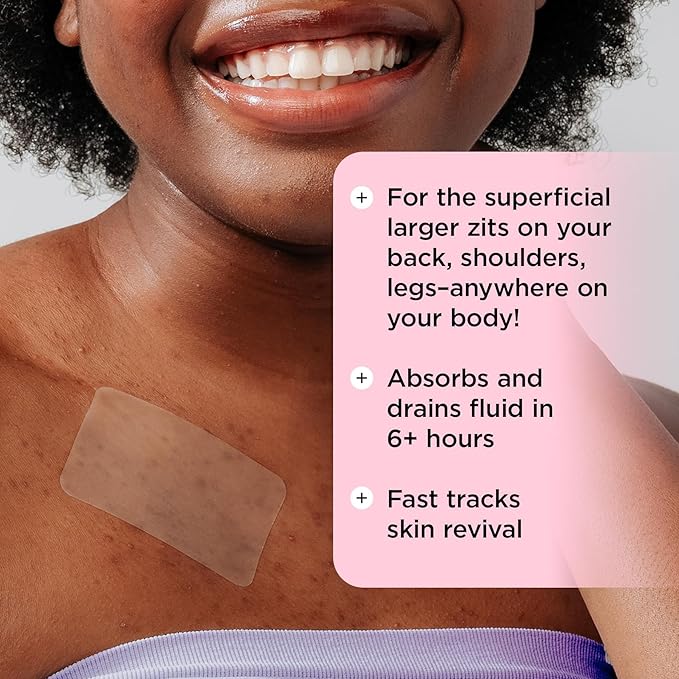 ZitSticka Large Pimple Patches for Face and Body, Goo Getter Hydrocolloid Patches to Cover Zits & Blemishes, Acne Patches or Zit Spot Stickers, Blemish Patch (Body Patch 9 Pack)