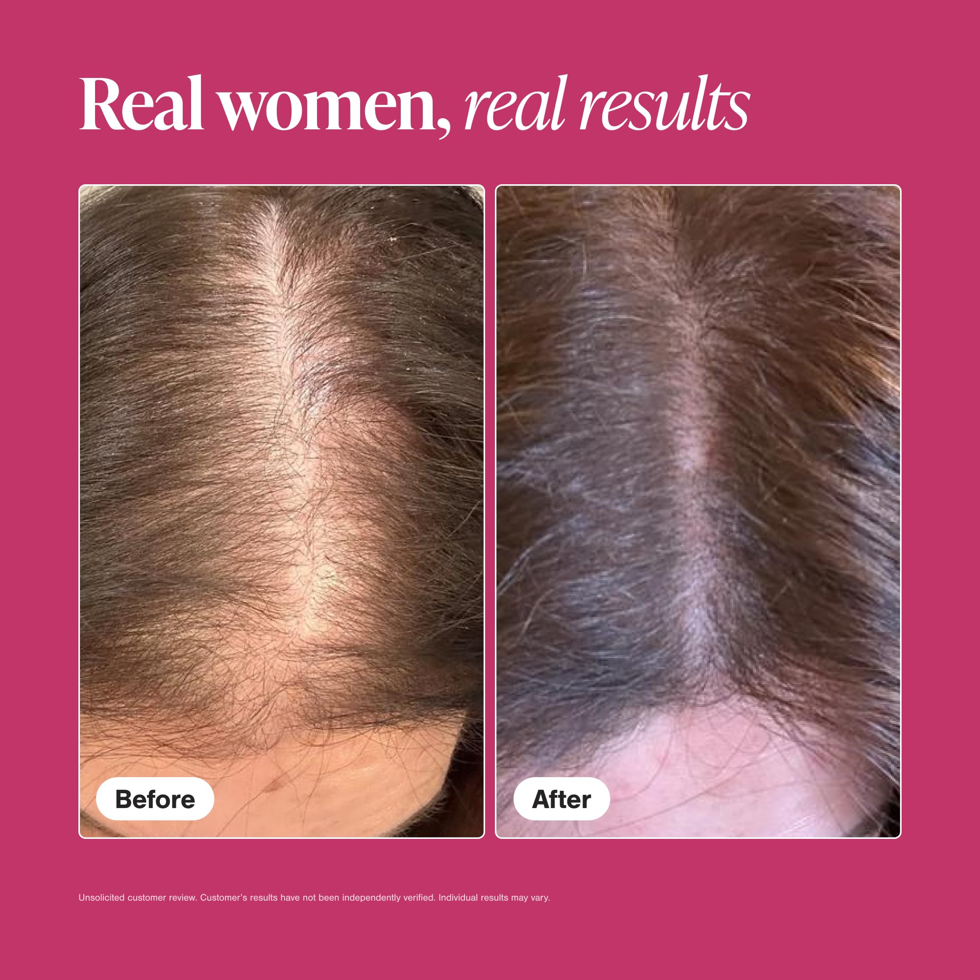 Viviscal Hair Growth Supplements for Women, Thicker Fuller Hair Support for Thinning Hair and Hair Loss, with Biotin and Marine Collagen, Drug-Free, 180 Tablets, 90-Day Supply
