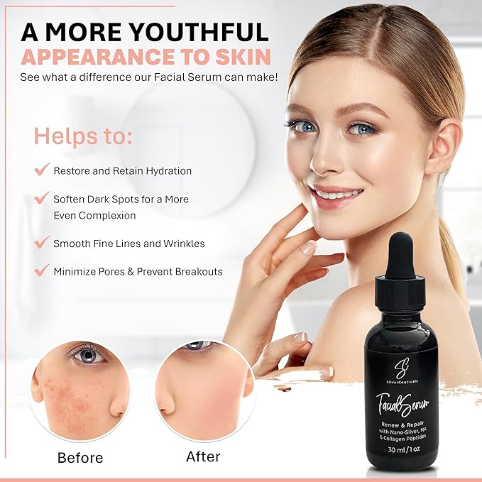 Facial Serum - Hyaluronic Acid, Collagen, Nano Silver, Acne, Wrinkles - 1oz