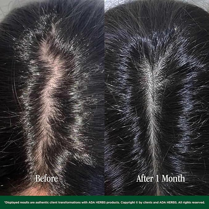 ADA HERBS Hair Oil Mask Pre-Wash & Overnight 100% Natural Hair Growth Oil with Cold Pressed Argan, Castor, Jojoba, Rosemary, Vitamin E (8.45 Fl Oz)