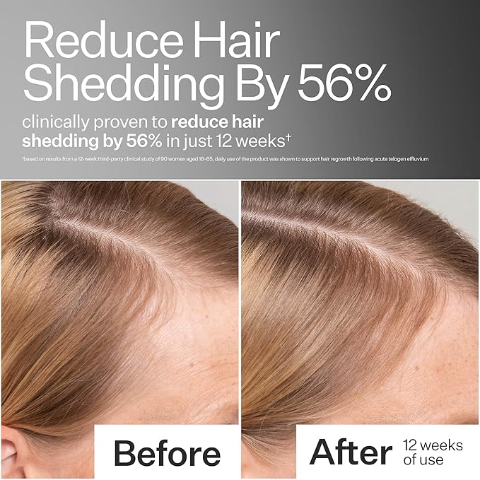 Act+ Acre, Stem Cell Scalp Serum, Reduces Shedding, 2.2 fl oz