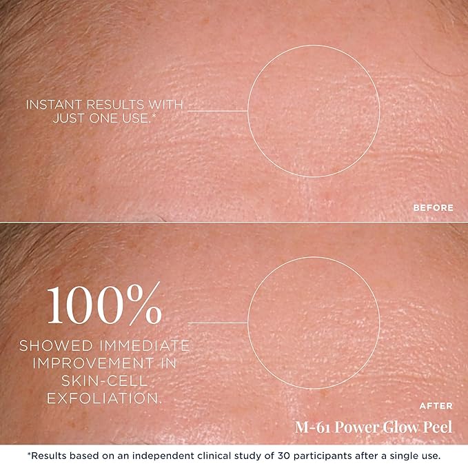 m-61 PowerGlow Peel, 60 Treatments
