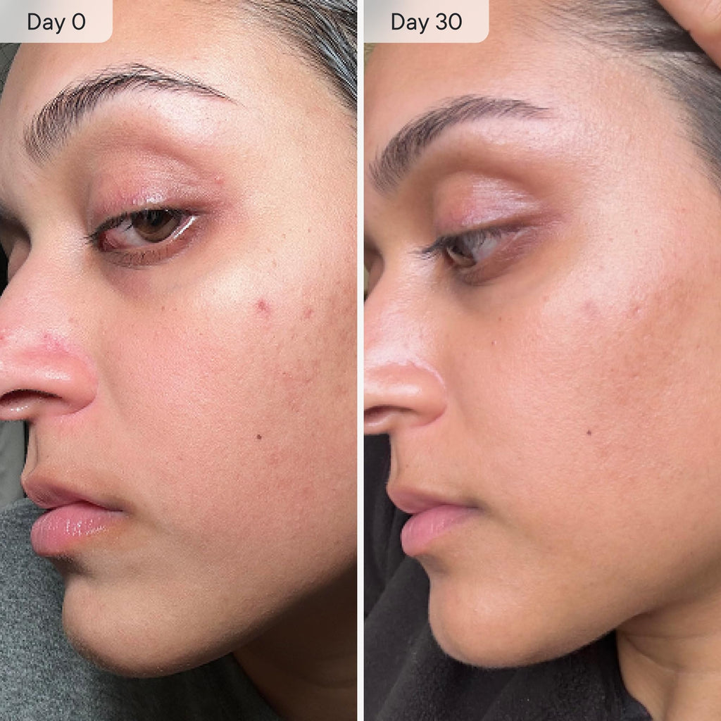 Qure Micro Infusion System for Face & Neck - Facial Moisturizing Essence, Hydrating Serum for All Skin Types, Refreshed Skin - 3-Month Supply
