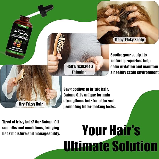 Batana Hair Growth Oil – Cold Pressed Hair Thickening & Strengthening Oil with Rosemary & Castor Oil – Scalp Treatment for Dry, Damaged & Thinning Hair, Men & Women