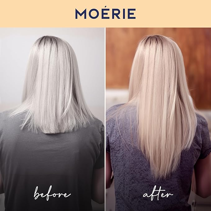 Moérie Hair Growth Shampoo, Conditioner and Mask - Hair Loss Solution with Biotin and Rosemary, Thickening Hair Regrowth Set for Thinning Hair - Ultimate Hair Growth Care (Double Set)