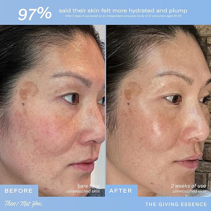 Then I Met You The Giving Essence, Korean Skin Care Toner With Niacinamide
