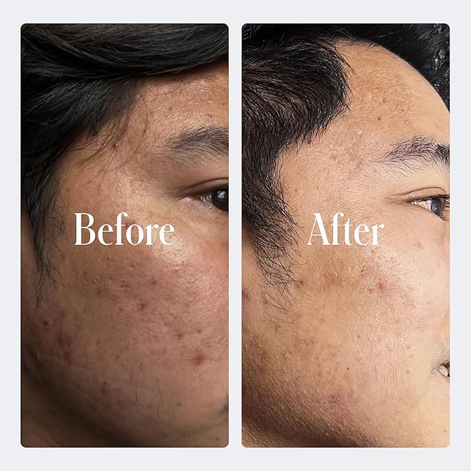 Geologie Retinol Anti-Aging Face Cream | Enhanced.2% Retinol Formula for Effective Results | Reduce Fine Lines & Wrinkles | Protect & Repair Skin With Hyaluronic Acid & Niacinamide | For Men & Women