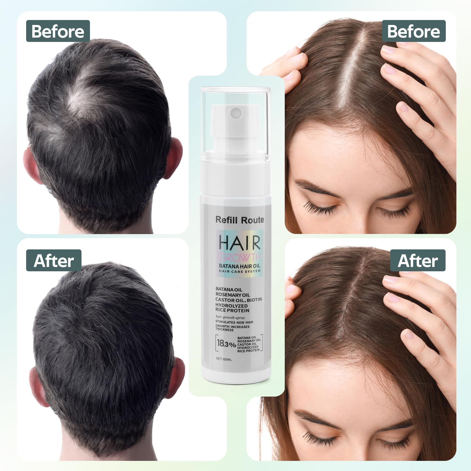 Batana Oil for Hair Growth Spray - Natural Raw Batana Oil Hair Regrowth Treatment for Women/Men with Rice Water, Biotin, Castor, Rosemary for Thicker, Stronger Hair - Vegan Hair Growth Spray