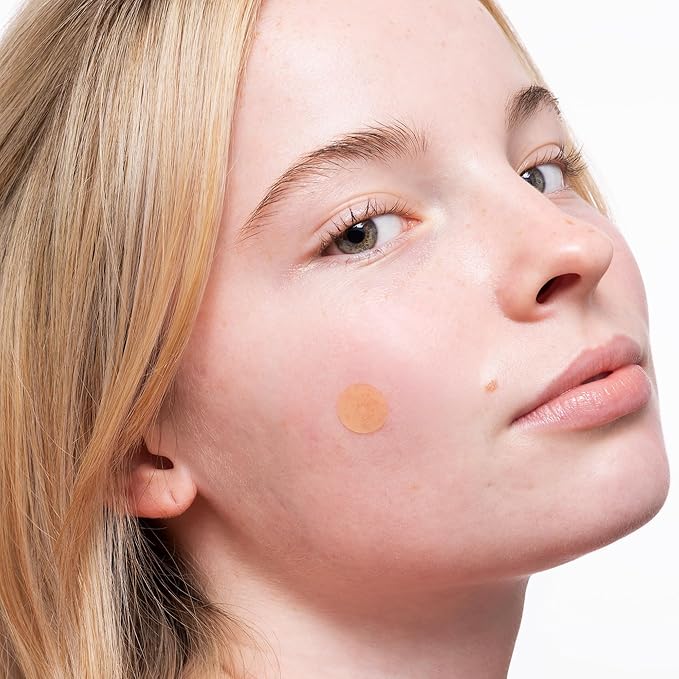 PEACE OUT Acne Healing Dots Hydrocolloid Pimple Patches (20 count)