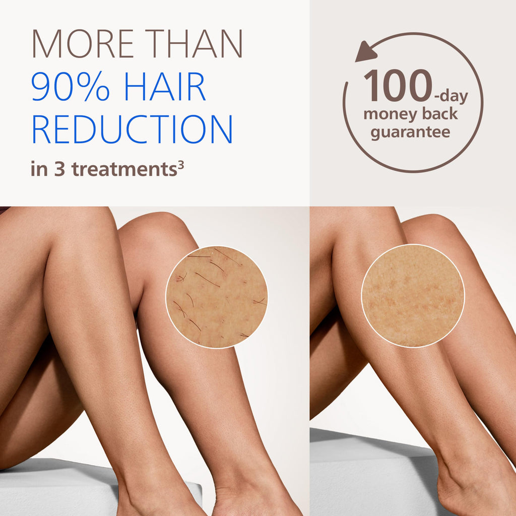 Philips Lumea IPL — Salon-Like Laser Hair Removal for Women, Permanent Hair Reduction Device At Home for Face & Body — Safe & Painless for Face, Bikini, Body, 5 Settings & Skin Sensors, BRI984/03