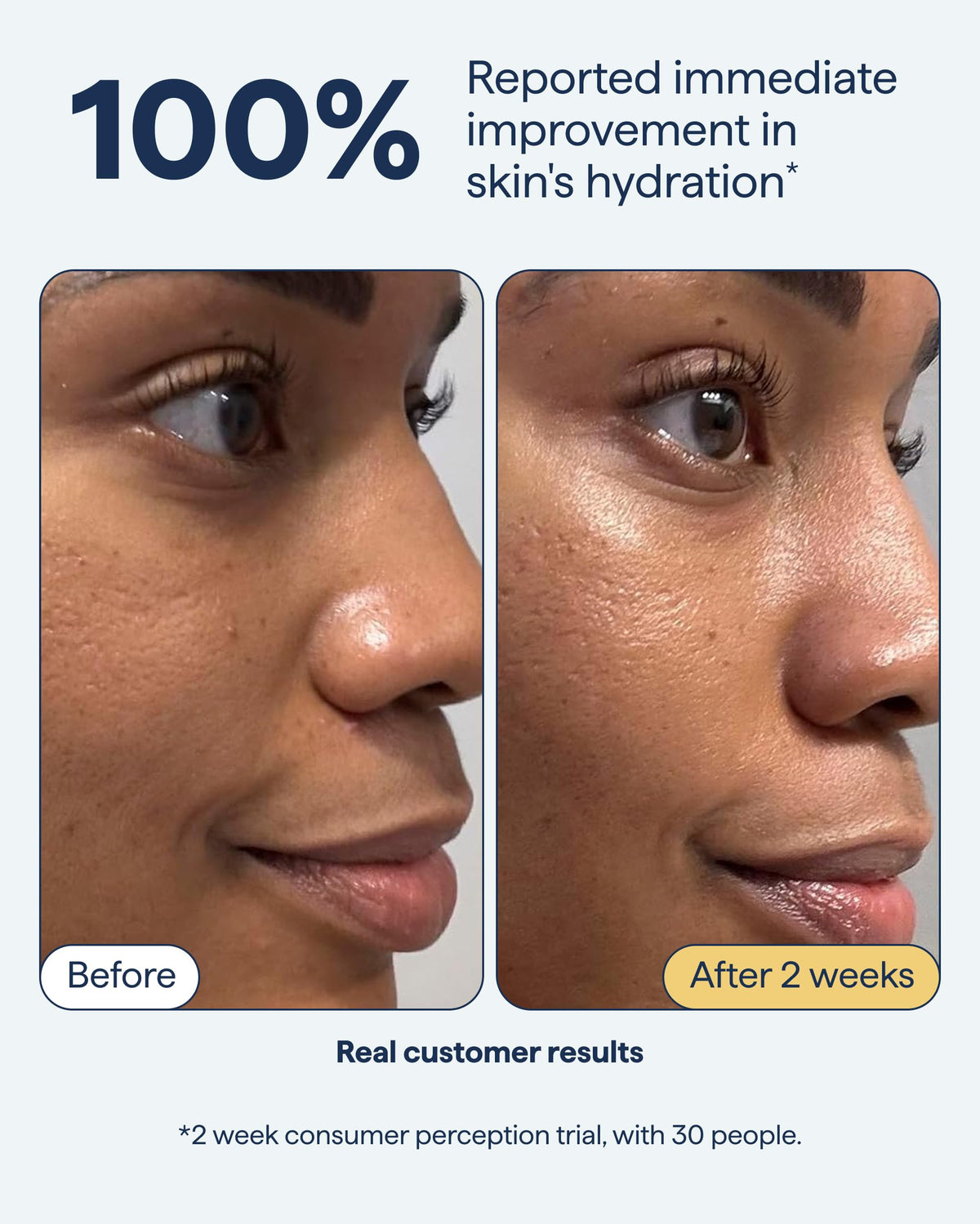 REMEDY Rich Barrier Repairing Cream Face Moisturizer for Dry Sensitive Skin