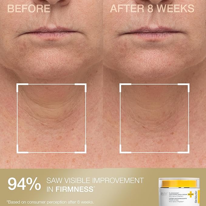StriVectin Contour & Tighten Lifting Duo, 2x 1.7 oz