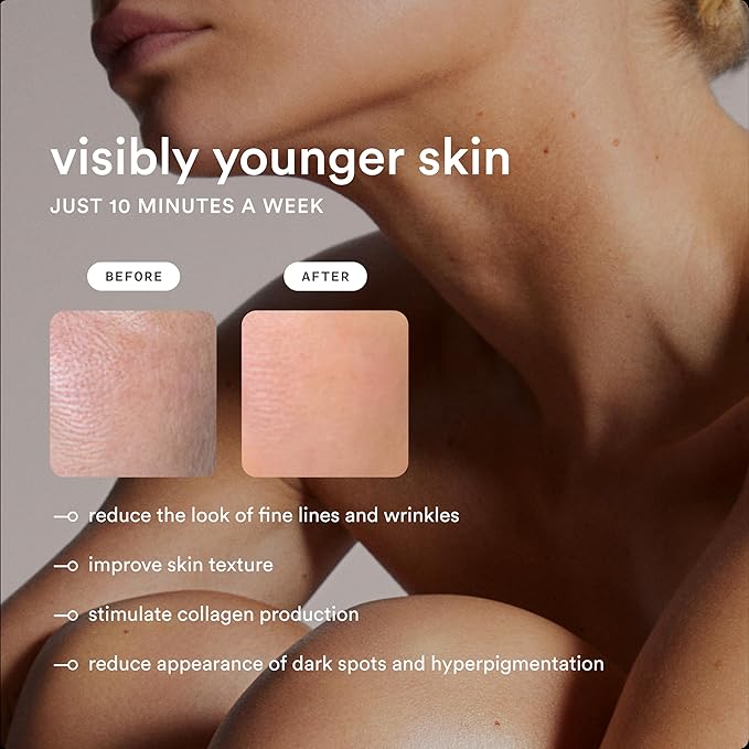 Nood™ Flasher Pro — Forbes Best Product 2026 — IPL Laser Hair Removal Device For At Home Use — Pain-Free, Permanent, Visible Results After First Use & Works Everywhere Hair Grows — Matte Black