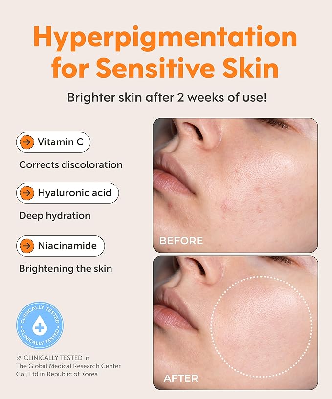 SERUMKIND Youth & Glow Serum, Capsule Formula for Firming & Radiance Care, Sea Buckthorn & Shikonin Oils, Korean Skincare (1.01 fl oz / 30 ml)