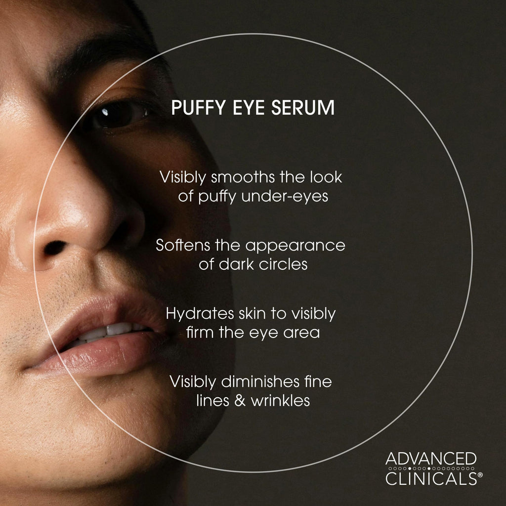 Advanced Clinicals Puffy Eye Under Eye Serum | Visible Anti Aging Brightening Vitamin C + Caffeine Serum Helps Improve Look Of Puffiness, Fine Lines, Dark Circles, & Uneven Skin Tone, 1.75 Fl Oz