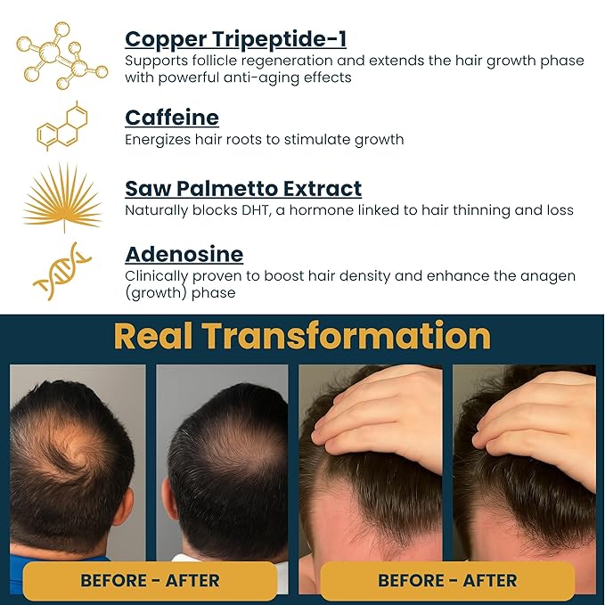 Seraphime Copper Peptide Serum for Hair Growth - Caffeine, Niacinamide, Rosemary Oil, Saw Palmetto Hair Density Serum, Topical Tripeptide Scalp Care for Hair Thinning, Women & Men 1 fl oz