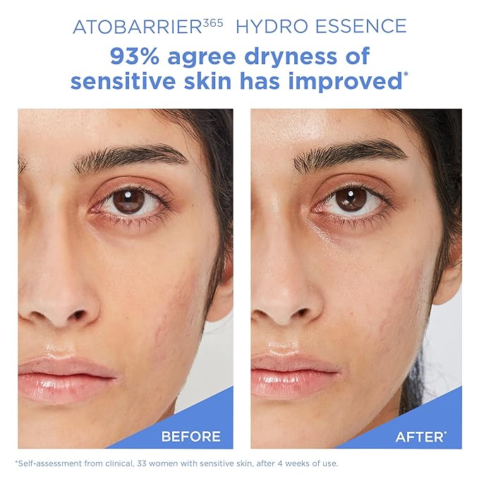 AESTURA ATOBARRIER365 Hydro Essence 6.76 Fl Oz, Lightweigh Moisturizer with Supporting Moisture Barrier, Dermatologist Tested, Non-comedogenic