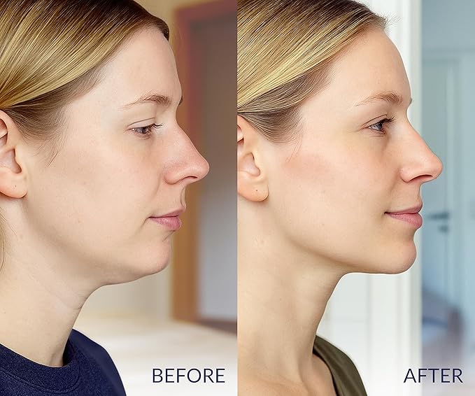 Stylia V Line Lifting Collagen Mask - Lift, Firm & Contour Jawline - Tightening Double Chin Strap with Hyaluronic Acid & Aloe - Neck Tightening and Lifting Mask - Jawline Shaper Face Lift Tape (10PC)