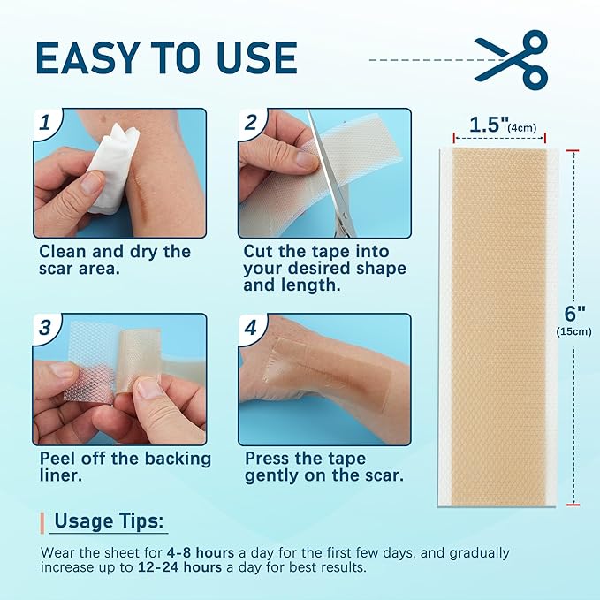 MEDLOT Silicone Scar Sheets, 10pcs, Silicone Tape for Scar Treatment, Reusable Scar Strips for Surgical, C-Section, Keloid Bump, Stretch Marks, Burn, Acne Scar Removal, Each 1.5” x 6”