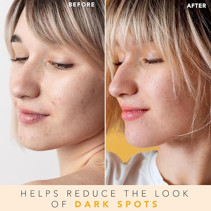 Vitamin C Face Toner - USA Made with Natural & Organic Ingredients
