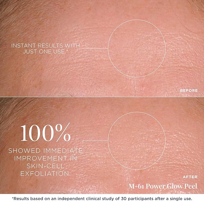 m-61 PowerGlow Peel Exfoliating Facial Peel, 10 Treatments