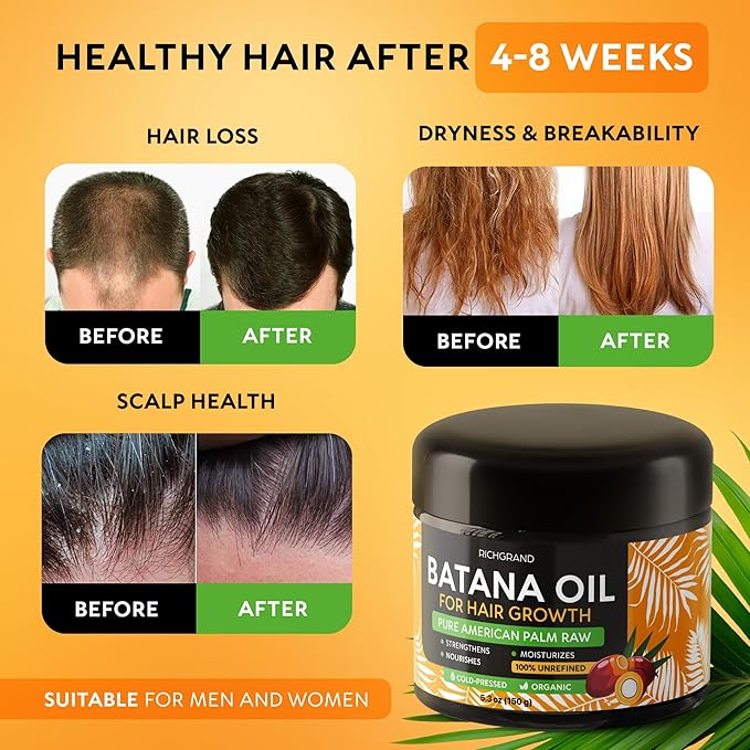 RICHGRAND Batana Oil for Hair Growth & Skin - 100% Raw Unrefined Batana Butter from Honduras - Multipurpose Body Moisturizer - Natural Cold Pressed Oil for Scalp, Split Ends & Dryness (5.3 oz)