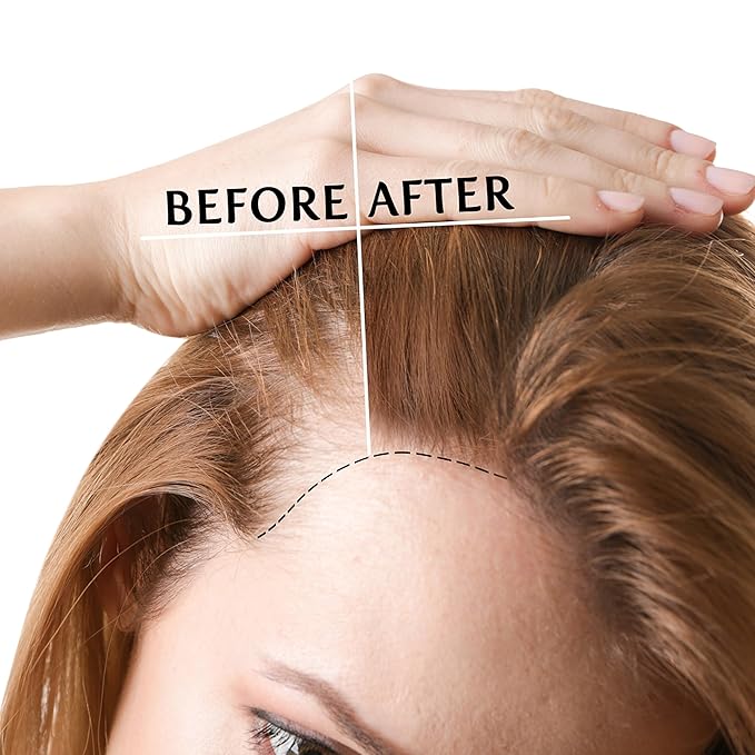 SNOB GIRLS NORMADENSE Thickening Hair Serum Capsules for Fine & Thin Hair