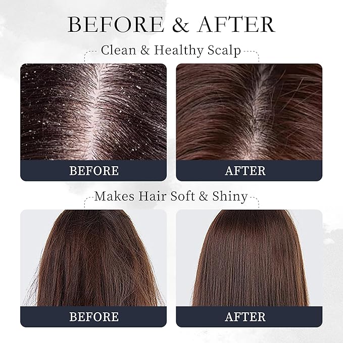 Novastile Rosemary Hair Oil – Dry Scalp & Split End Treatment with Biotin & Essential Oils for Strengthening, Nourishing, Moisturizing & Supporting Longer, Healthier Hair