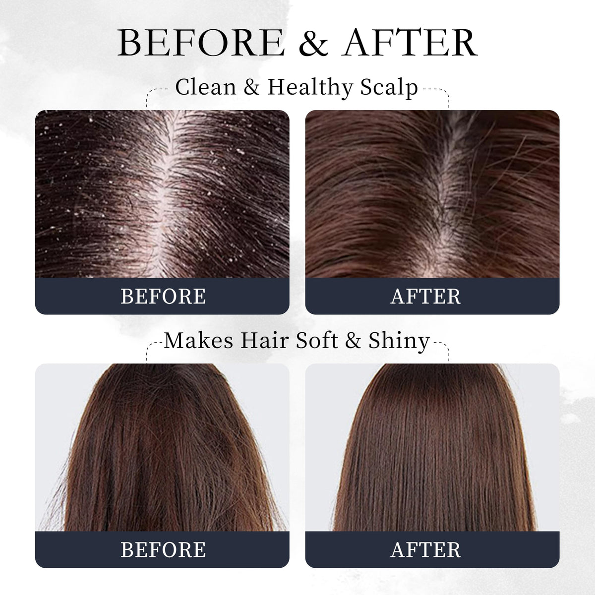 Novastile Rosemary Hair Oil – Dry Scalp & Split End Treatment with Biotin & Essential Oils for Strengthening, Nourishing, Moisturizing & Supporting Longer, Healthier Hair