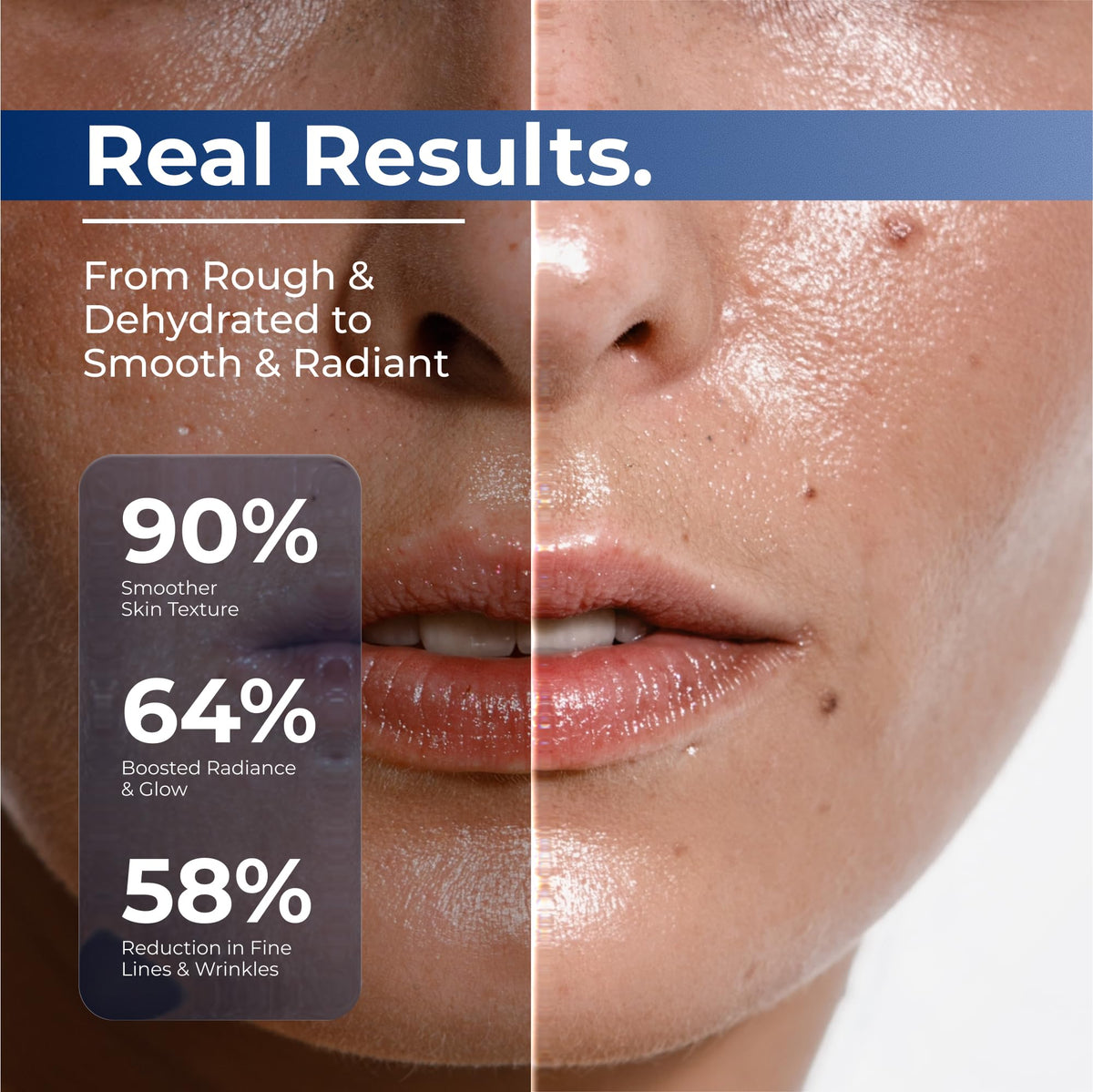 TURMSKIN® Hyaluronic Acid Serum Ampoules [ULTRA HYDRATING VIALS] - 3% Hyaluron Booster for Glass Skin & Anti Aging - 24 Hours Hydration - Soft PE Triple Hyaluronic Complex for Faceskin Repair & Renew