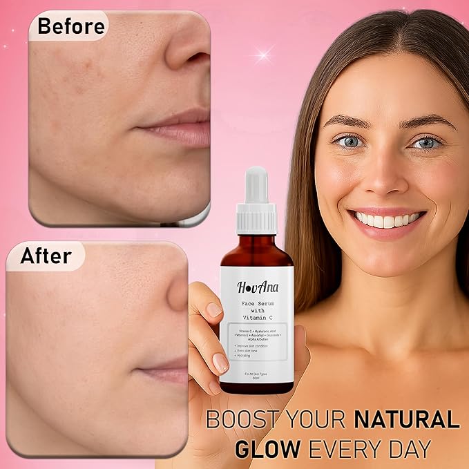 Vitamin C Brightening Face Serum with Hyaluronic Acid & Vitamin E – Lightweight Hydrating Facial Serum for Even-Looking Skin Tone, All Skin Types, 50ml