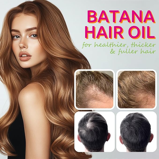 AKBAN Hair Growth Oil with 100% Pure Batana, Castor, Rosemary & Pumpkin Seed Oils – Infused with Biotin, Keratin & Vitamin E – Strengthening & Thickening Treatment for Healthy Hair – 4 FL OZ