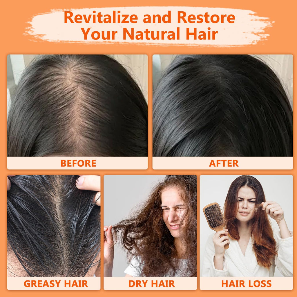 Natural Batana Hair Revival Formul, 4-in-1 Liquid Batana Oil, Batana Oil for Hair, Rosemary Oil for Hair, for Men and Women, Prevents Dry Hair & Hair Loss for All Hair Types (1PCS)