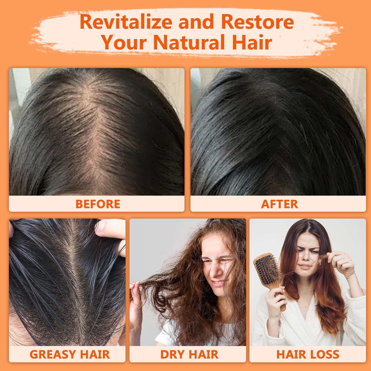 Natural Batana Hair Revival Formul, 4-in-1 Liquid Batana Oil, Batana Oil for Hair, Rosemary Oil for Hair, for Men and Women, Prevents Dry Hair & Hair Loss for All Hair Types (1PCS)