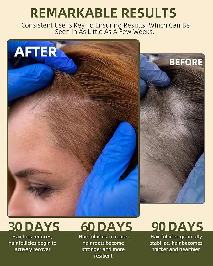 Ktintar 100% Natural Raw Batana Oil for Hair Growth, Dr Sebi Hair Growth Oil From Honduras, Thicker & Stronger Hair, Prevents Hair Loss, Eliminates Split Ends 8.46 Fl Oz (Pack of 1)