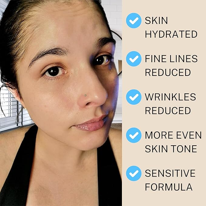 SKIN AURA™ Advanced Anti-Aging Serum | All-In-One Sensitive Formula for Wrinkles, Fine Lines & Age Spots | Plant Derivative with Hyaluronic Acid, Collagen Peptides, 5 Vitamins + Minerals - 30ml (1oz)