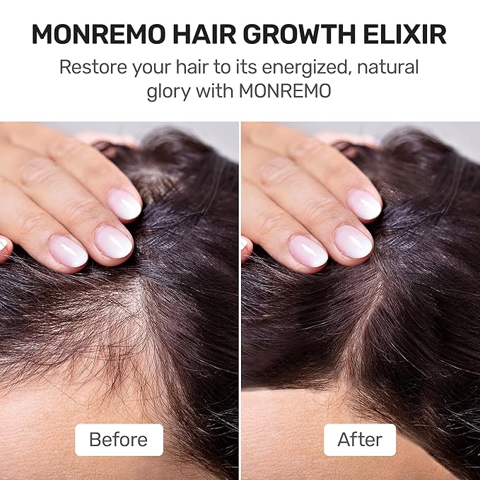 MONREMO Caffeine Hair Growth Serum with Biotin & Turmeric for Women & Men