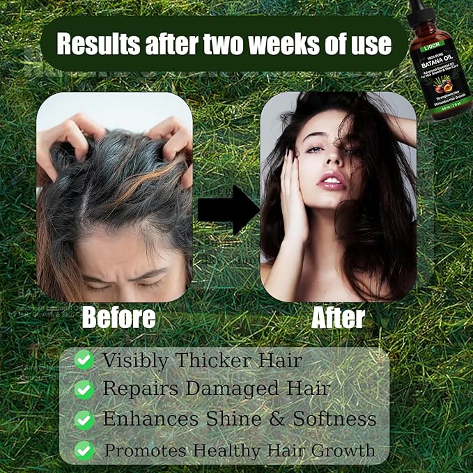 Batana Hair Growth Oil – Cold Pressed Hair Thickening & Strengthening Oil with Rosemary & Castor Oil – Scalp Treatment for Dry, Damaged & Thinning Hair, Men & Women