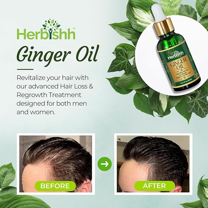 Herbishh Hair Growth Oil with Ginger Extract – Fast Hair Thickening & Dense Regrowth Serum – Compact 30ml Hair Care Product for Women & Men