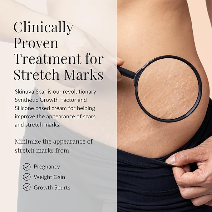 Skinuva® Stretch Mark Cream (2.5 oz)
