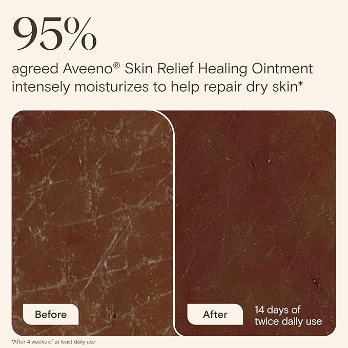 Aveeno Skin Relief Healing Ointment, for Extra Dry, Cracked & Sensitive Skin, 72-Hour Protectant with Triple Oat, Shea Butter & Glycerin, Fragrance-Free for Body, Face, Hands, Lips 7.2 oz
