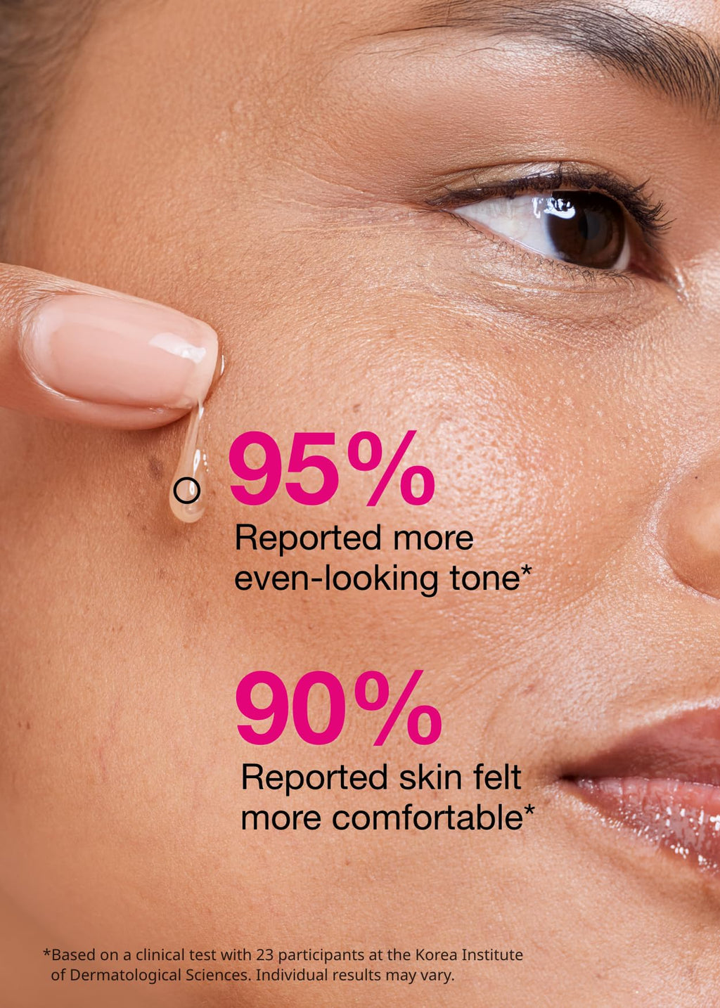 ISOI Blemish Care Up Serum with Arbutin & Rose Otto Oil, 0.85 fl oz