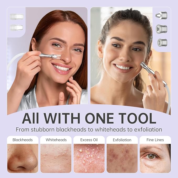 UNOISETION Blackhead Vacuum Removers, 2 in 1 Pro-Grade At-Home Spa Facial Vacuum Pore Cleaner for Blackheads, Whiteheads, Exfoliation, 20-80 Kpa Adjustable Suction for All Skin Types, White