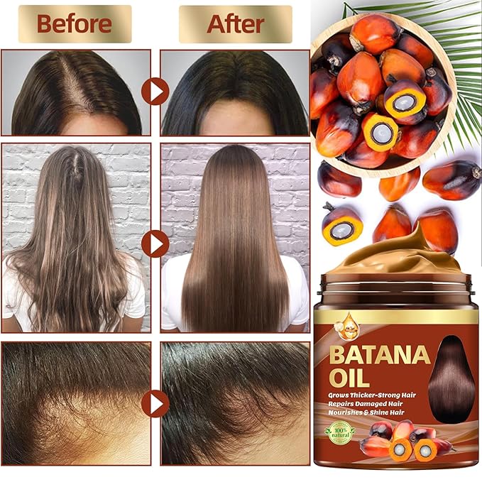 Batana Oil for Hair Growth & Rosemary Oil for Hair Growth,Raw Batana Hair Mask Rosemary Hair Growth Serum,Hair Oil for Dry Damaged Hair,Promotes Hair Thickness for Men Women