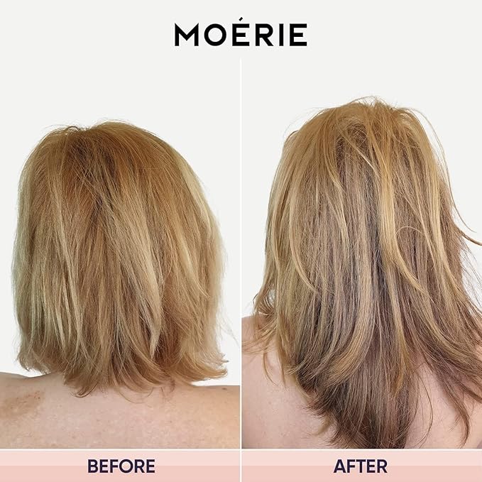 Moerie Mineral Hair Growth & Repair Mask – Hair Loss treatment Mask – Hair Regrowth For Longer, Thicker, Fuller Hair - Vegan Friendly – Paraben & Silicone Free, Double Set