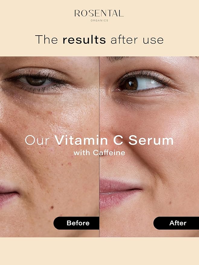 Rosental Organics Vitamin C Serum with Caffeine (30ml) - Hydrating Facial Serum - Against dark pigment spots and acne scars - Wrinkles - Brightening facial care - Natural Cosmetics - Made in Germany